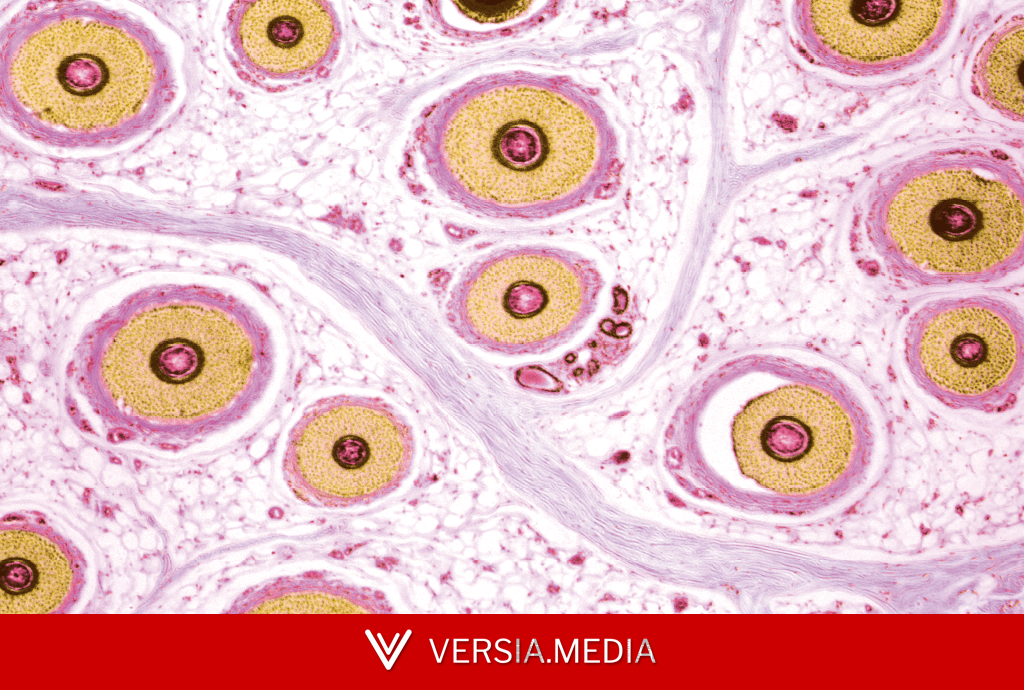 De onde saem os pelos do corpo? Superzoom revela detalhes impressionantes dessas estruturas