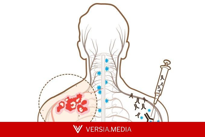 Canetas emagrecedoras: estudo alerta para maior risco de herpes-zóster após o uso
