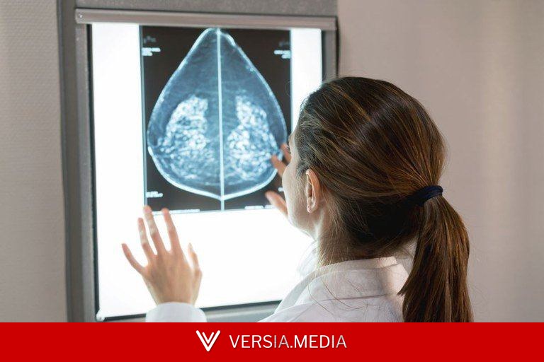 Mamografia digital sem restrição de idade pode entrar na cobertura obrigatória dos planos
